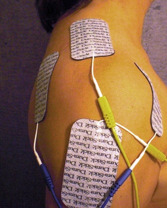 électrodes épaule